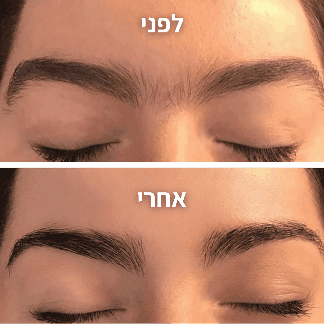 מסיר השיער של menela