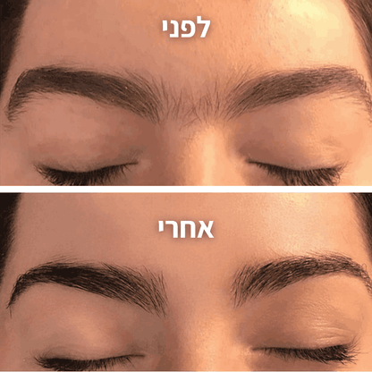 מסיר השיער של menela