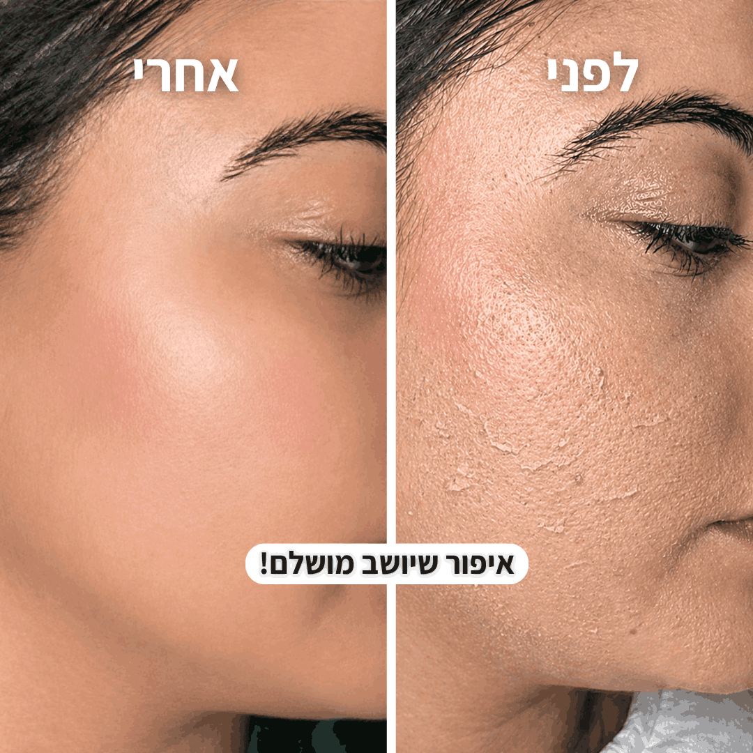 מסיר השיער של menela